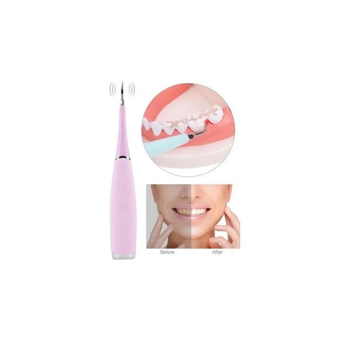 Limpiador Dientes Sarro recargable Rosado